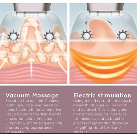 HoMedics - cellulitmassage CELL-500 HoMedics - cellulitmassage CELL-500